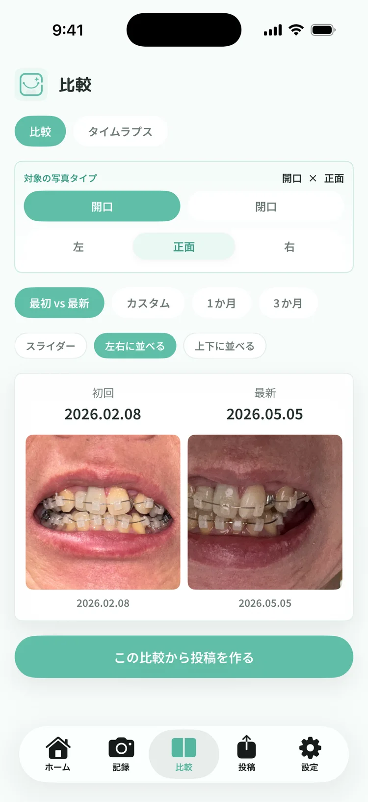 2 枚を左右に並べて見比べている画面