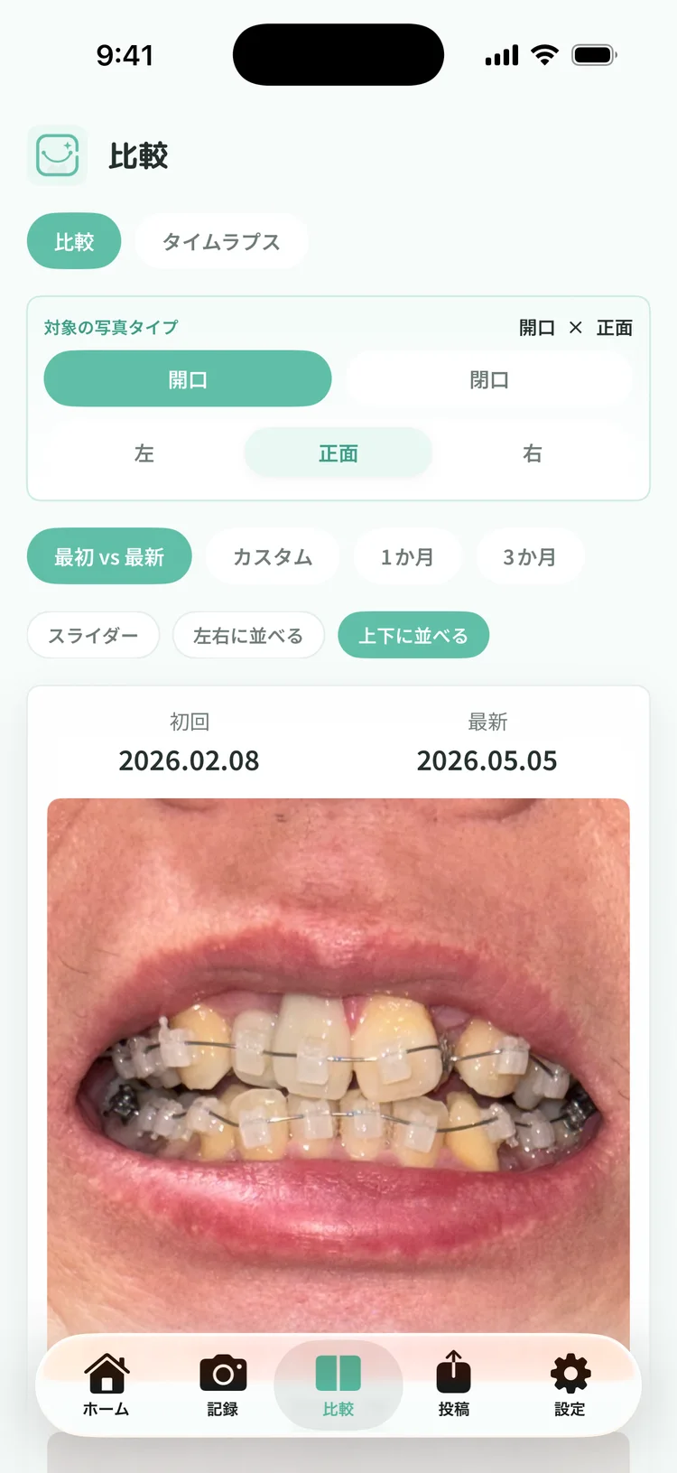 2 枚を上下に並べて見比べている画面