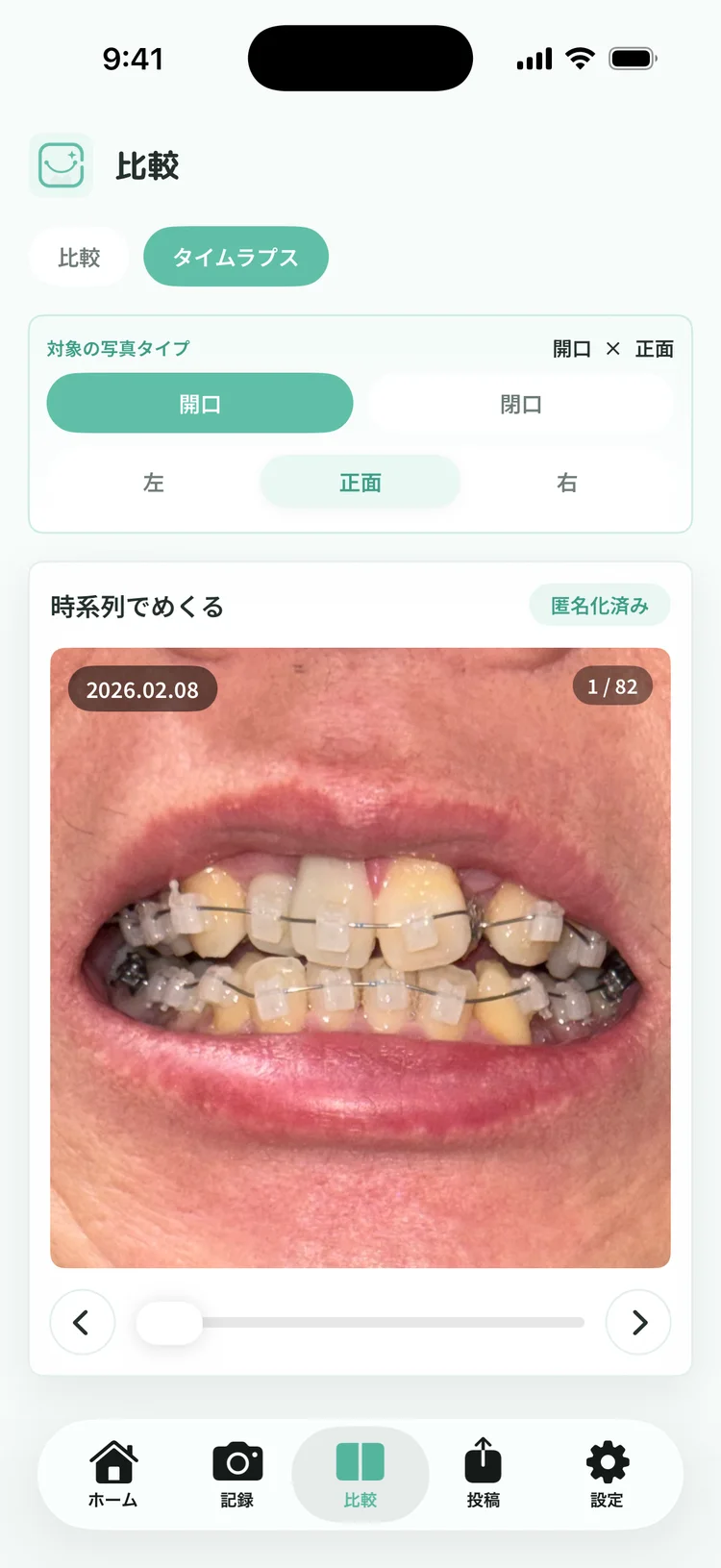 同じ種類の写真を時系列でめくっている画面